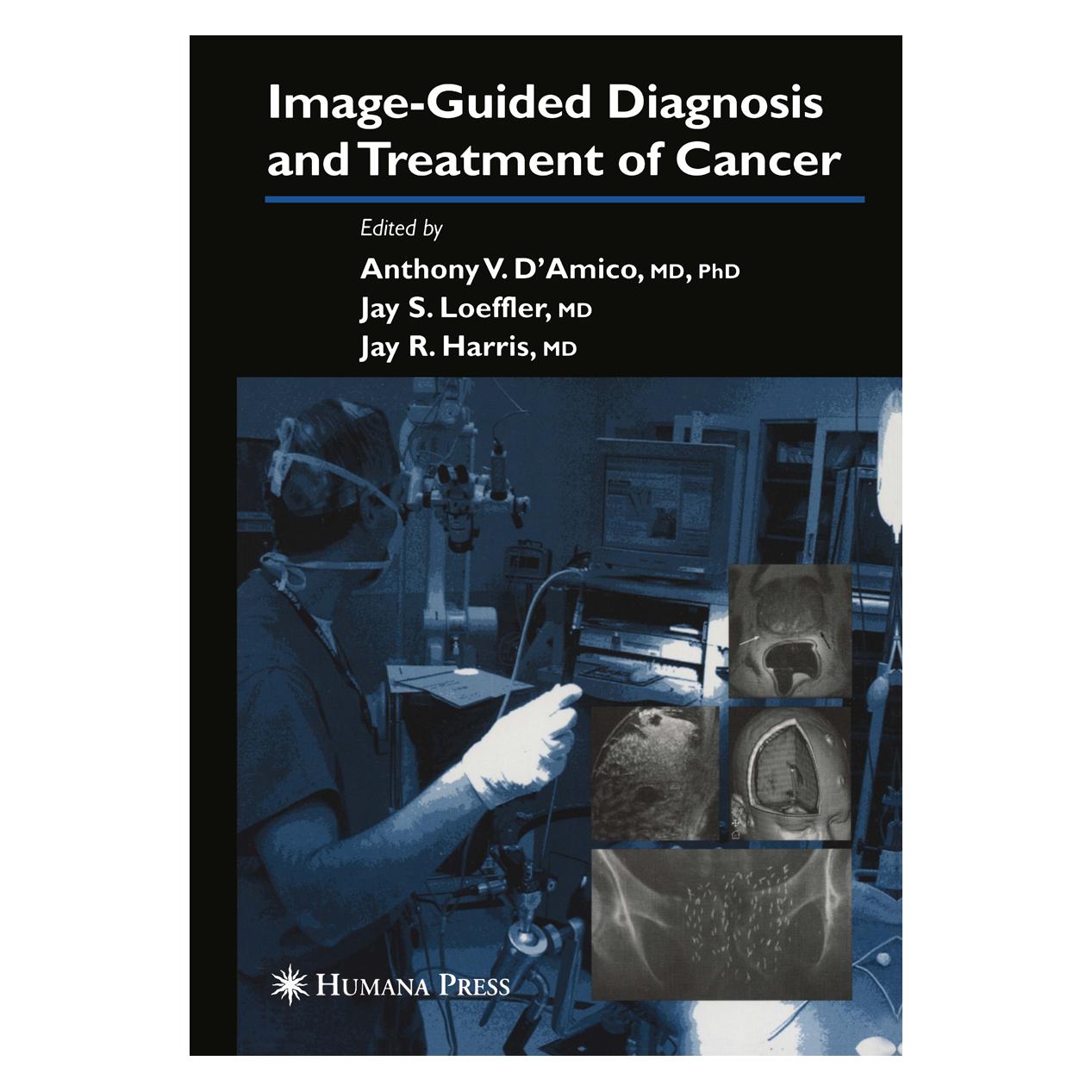 Springer Image-Guided Diagnosis and Treatment of Cancer (Englisch, Softcover, Anthony V. D'Amico, Jay R. Harris) (55382696)