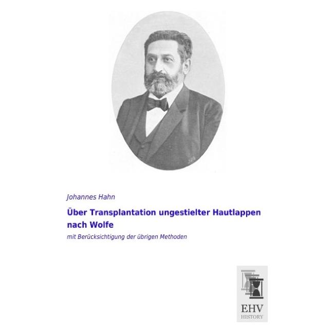 EHV-History Über Transplantation ungestielter Hautlappen nach Wolfe (Deutsch, Softcover, Johannes Hahn) (55563752)