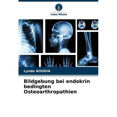 Bildgebung bei endokrin bedingten Osteoarthropathien, Taschenbuch von Lynda Aoudia, Verlag Unser Wissen, 978-620-7-74322-3