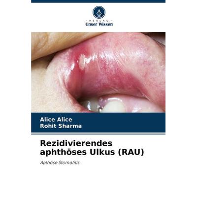 Rezidivierendes aphthöses Ulkus (RAU), Taschenbuch von Alice Alice,Rohit Sharma, Verlag Unser Wissen, 978-620-7-41883-1