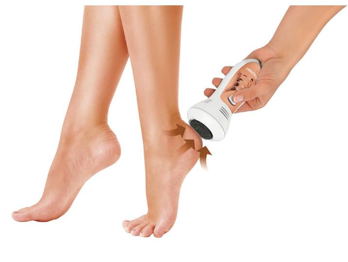 VITALmaxx Hornhautentferner mit Saugfunktion, Weiss-Roségold