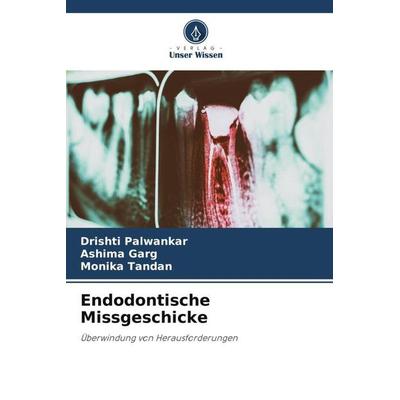 Endodontische Missgeschicke, Taschenbuch von Drishti Palwankar,Ashima Garg,Monika Tandan, Verlag Unser Wissen, 978-620-5-86948-2