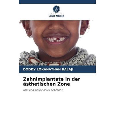 Zahnimplantate in der ästhetischen Zone, Taschenbuch von Doddy Lokanathan Balaji, Verlag Unser Wissen, 978-620-5-65357-9