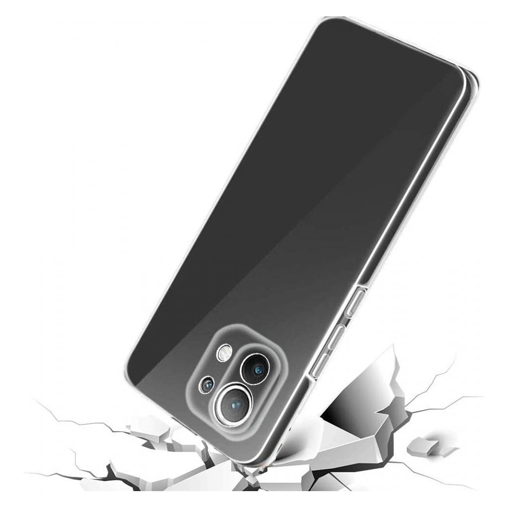 Screenguard 360° Screen & Body Protector Xiaomi Mi 11 Hülle mit Folie (Xiaomi Mi 11) (00028210)