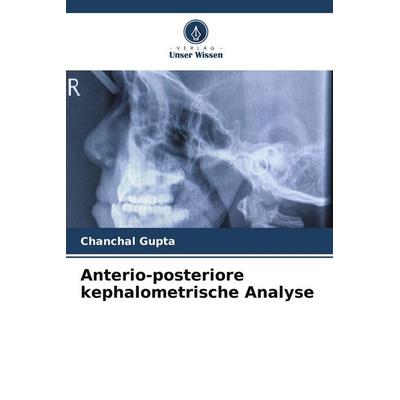 Anterio-posteriore kephalometrische Analyse, Taschenbuch von Chanchal Gupta, Verlag Unser Wissen, 978-620-5-73502-2
