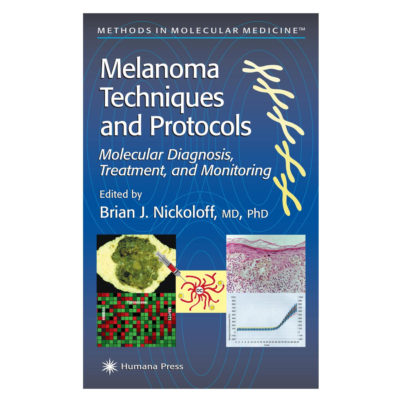 Springer Melanoma Techniques and Protocols (Englisch, Softcover, Brian J. Nickoloff) (9478462)
