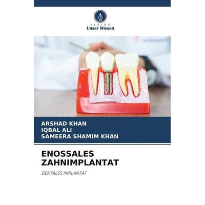 ENOSSALES ZAHNIMPLANTAT, Taschenbuch von Arshad Khan,Iqbal Ali,Sameera Shamim Khan, Verlag Unser Wissen, 978-620-5-43549-6