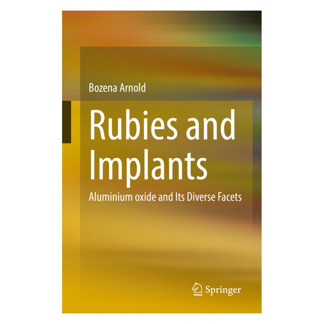 Springer Rubies and Implants (Englisch, Softcover, Bozena Arnold) (56883178)