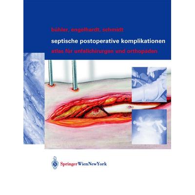 Septische postoperative Komplikationen, Gebundene Ausgabe von Matthias Bühler,Martin Engelhardt,Hergo G.K. Schmidt, Springer Wien, 978-3-211-83811-2