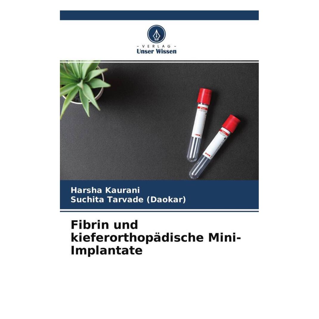 Unser Wissen Fibrin und kieferorthopädische Mini-Implantate (56847996)