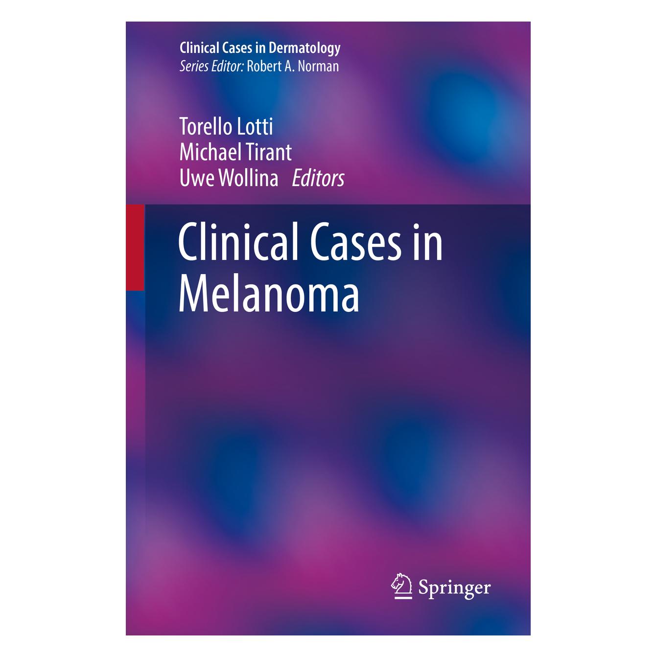 Springer Clinical Cases in Melanoma (Englisch, Softcover, Michael Tirant, Michael Torello Lotti, Uwe Wollina) (56142153)