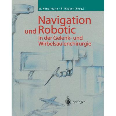 Navigation und Robotic in der Gelenk- und Wirbelsäulenchirurgie, Taschenbuch von , Springer Berlin, 978-3-642-62799-6
