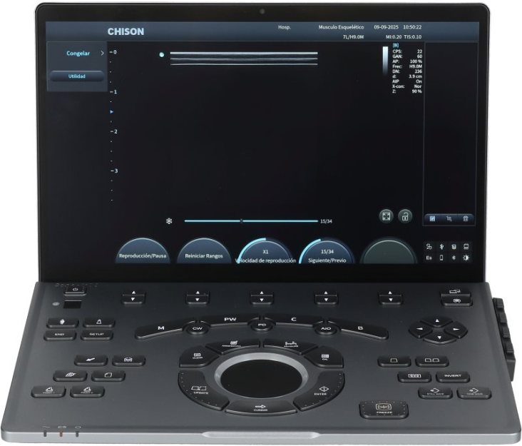 Ecógrafo Portátil Chison SonoAir 70 (Compra, aluga ou financia)