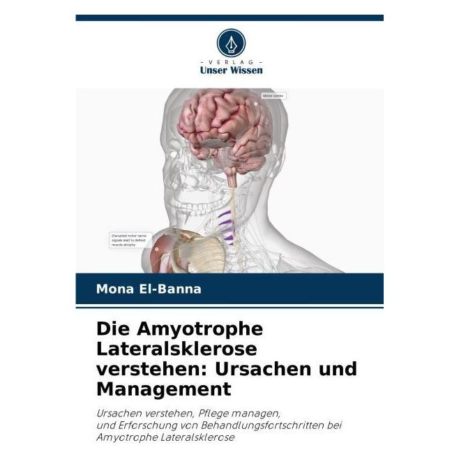 Umbreit Die Amyotrophe Lateralsklerose verstehen: Ursachen und Management (63584346)