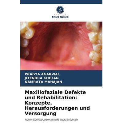 Maxillofaziale Defekte und Rehabilitation: Konzepte, Herausforderungen und Versorgung, Taschenbuch von Pragya Agarwal,Jitendra Khetan,Namrata Mahajan,