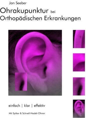 Jan Seeber - Ohrakupunktur bei Orthopädischen Erkrankungen: Balancierte Ohrakupunktur: einfach, klar, effektiv - Preis vom 16.10.2026 11:41:07 h