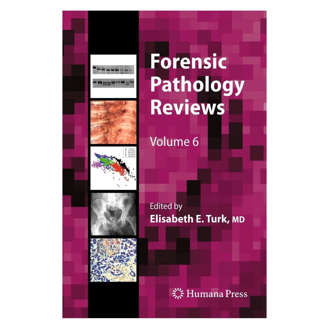 Humana Press Forensic Pathology Reviews (Englisch, Hardcover, Elisabeth E. Turk) (9781617792489)