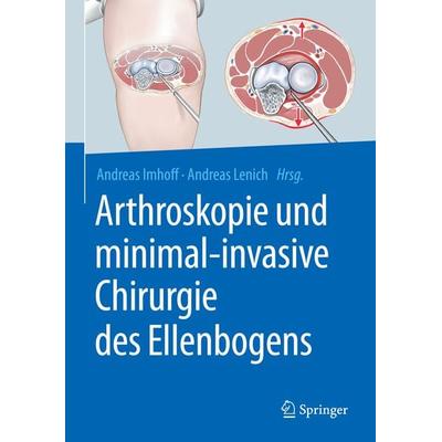 Arthroskopie und minimal-invasive Chirurgie des Ellenbogens, Gebundene Ausgabe von , Springer Berlin, 978-3-662-56678-7