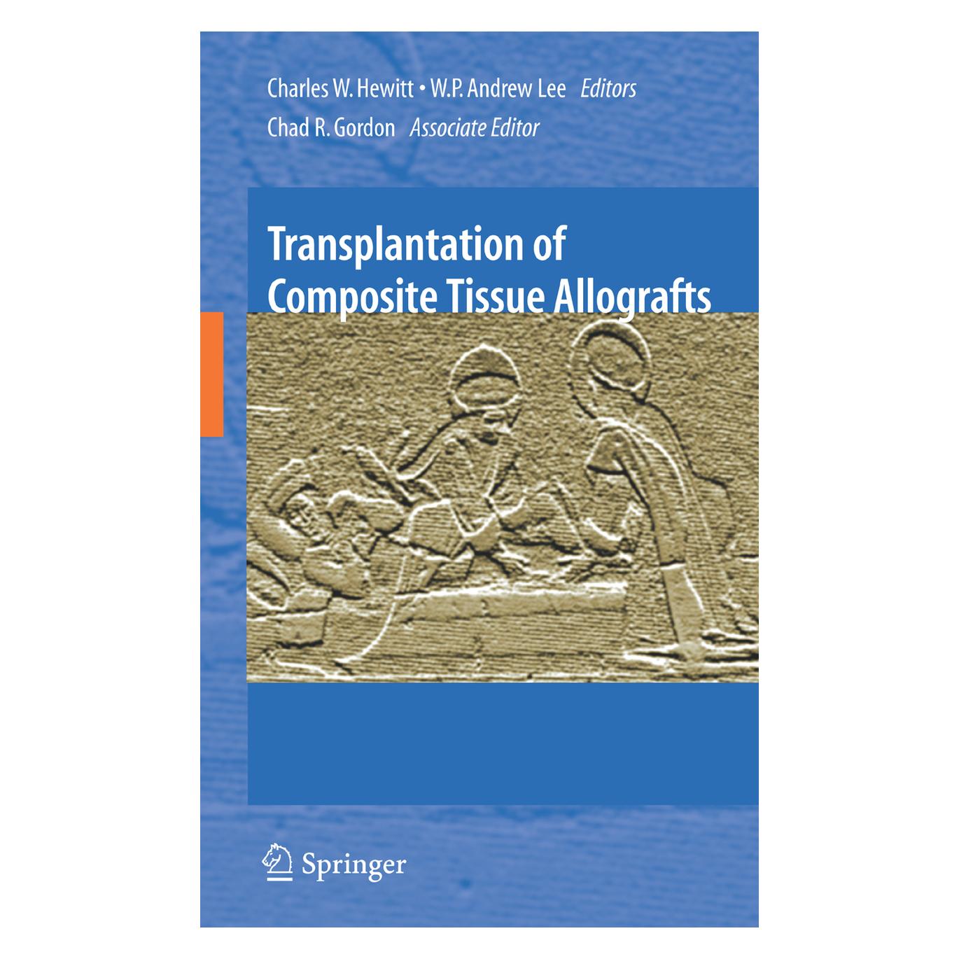 Springer Transplantation of Composite Tissue Allografts (Englisch, Softcover, Chad Charles W. Hewitt, P Andrew Lee, W.P. Andrew Lee, W/R Gordon) (55580051)