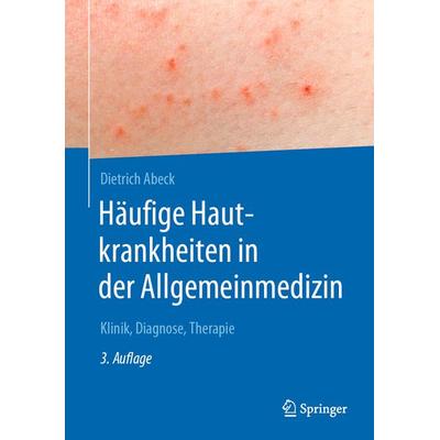Häufige Hautkrankheiten in der Allgemeinmedizin, Gebundene Ausgabe von Dietrich Abeck, Springer Berlin, 978-3-662-57446-1