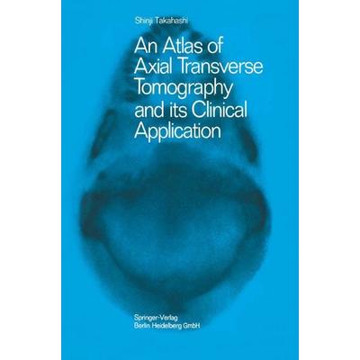 An Atlas of Axial Transverse Tomography and its Clinical Application, Taschenbuch von Shinji Takahashi, Springer Berlin, 978-3-662-24573-6