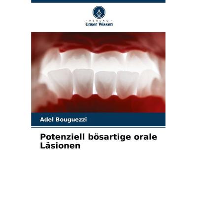 Potenziell bösartige orale Läsionen, Taschenbuch von Adel Bouguezzi, Verlag Unser Wissen, 978-620-8-58028-5
