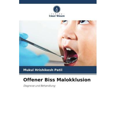 Offener Biss Malokklusion, Taschenbuch von Mukul Hrishikesh Patil, Verlag Unser Wissen, 978-620-6-43289-0