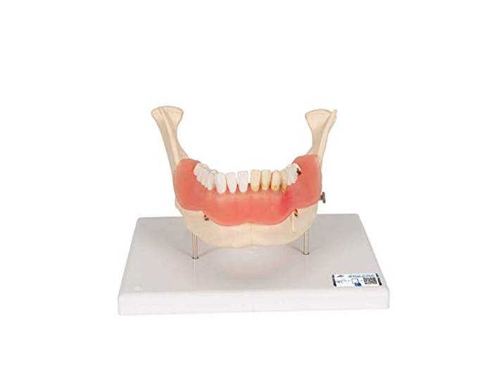 3B Scientific Menselijke anatomie - tandziektemodel, 2-voudig vergroot, 21-delig + gratis anatomiesoftware - 3B Smart Anatomy