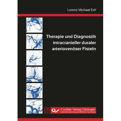 Therapie und Diagnostik intracranieller duraler arteriovenöser Fisteln, Taschenbuch von Lorenz Michael Ertl, Cuvillier Verlag, 978-3-7369-7476-0