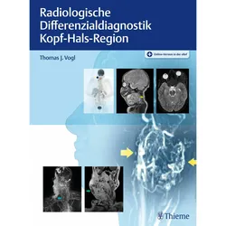 Radiologische Differenzialdiagnostik Kopf-Hals-Region, Fachbücher von Thomas J. Vogl