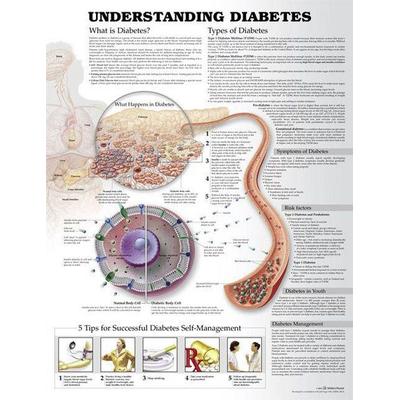 Understanding Diabetes Anatomical Chart, von Anatomical Chart Company Acc,Jeff Unger, Lippincott, 978-1-4698-9492-8