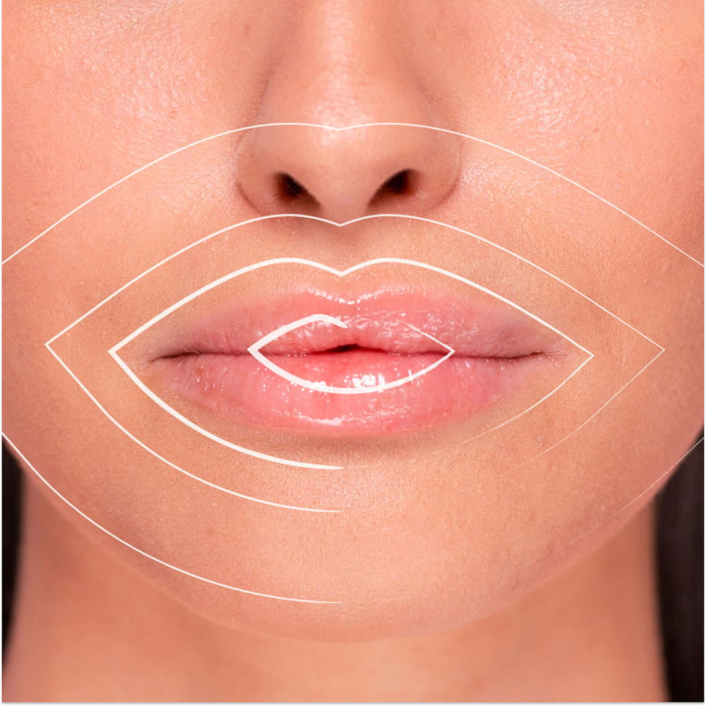 Freshly Cosmetics Volumateur pour lèvres Hyaluronique 5 ml