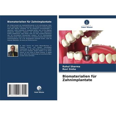 Biomaterialien für Zahnimplantate, Taschenbuch von Rahul Sharma,Ravi Sinha, Verlag Unser Wissen, 978-620-8-96301-9
