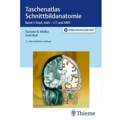 Taschenatlas Schnittbildanatomie, Set von Torsten Bert Möller,Emil Reif, Thieme, 978-3-13-240315-4