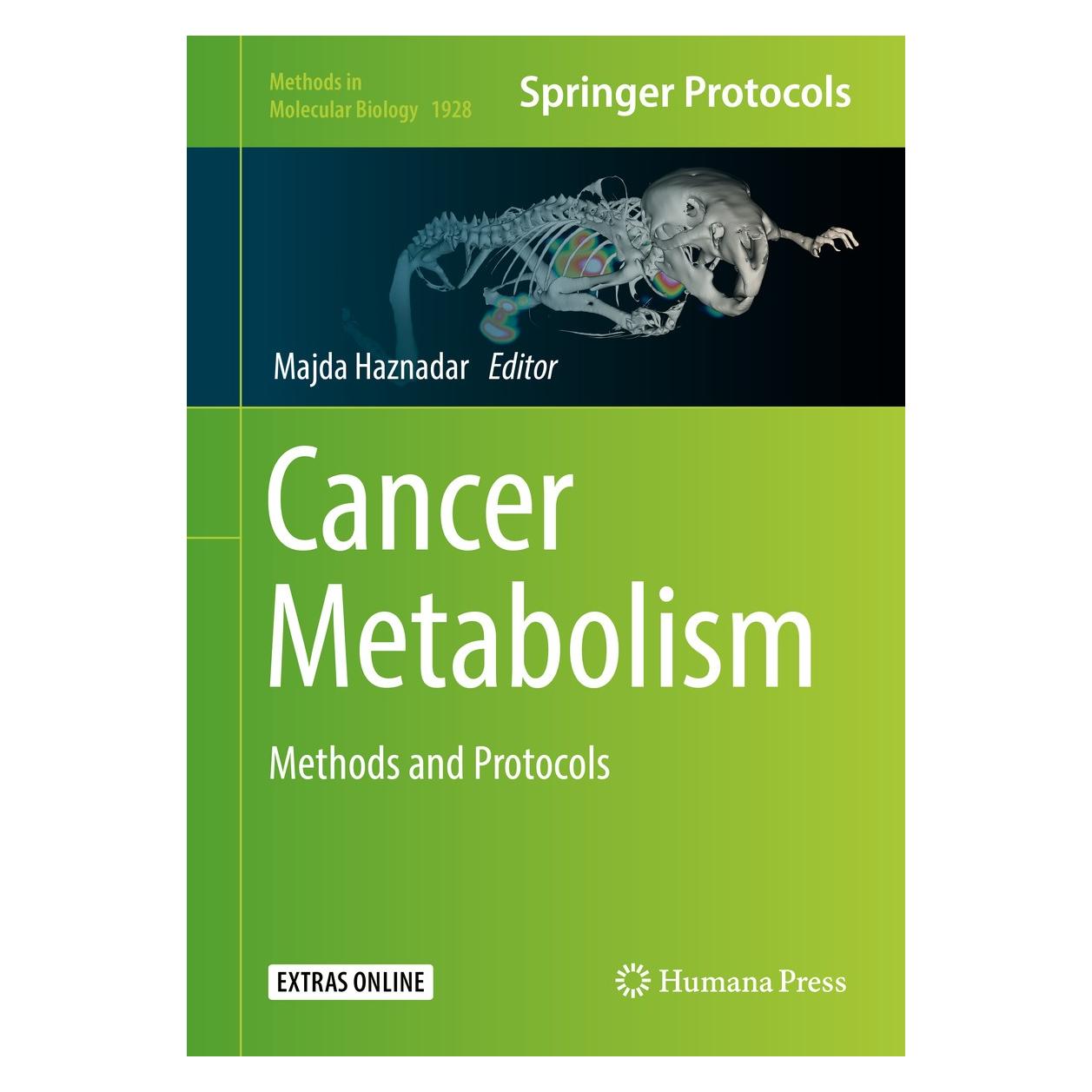 Springer Cancer Metabolism (Englisch, Hardcover, Majda Haznadar) (9781493990269)