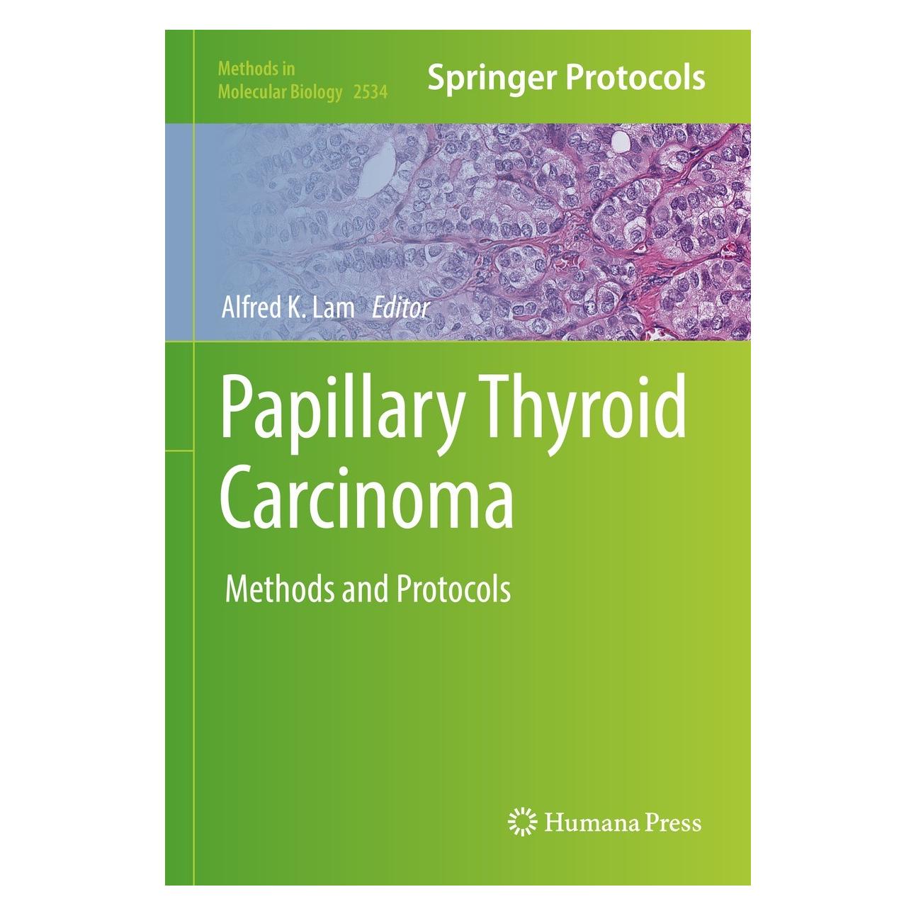 Springer Papillary Thyroid Carcinoma (Englisch, Hardcover, Alfred K. Lam) (9781071625040)