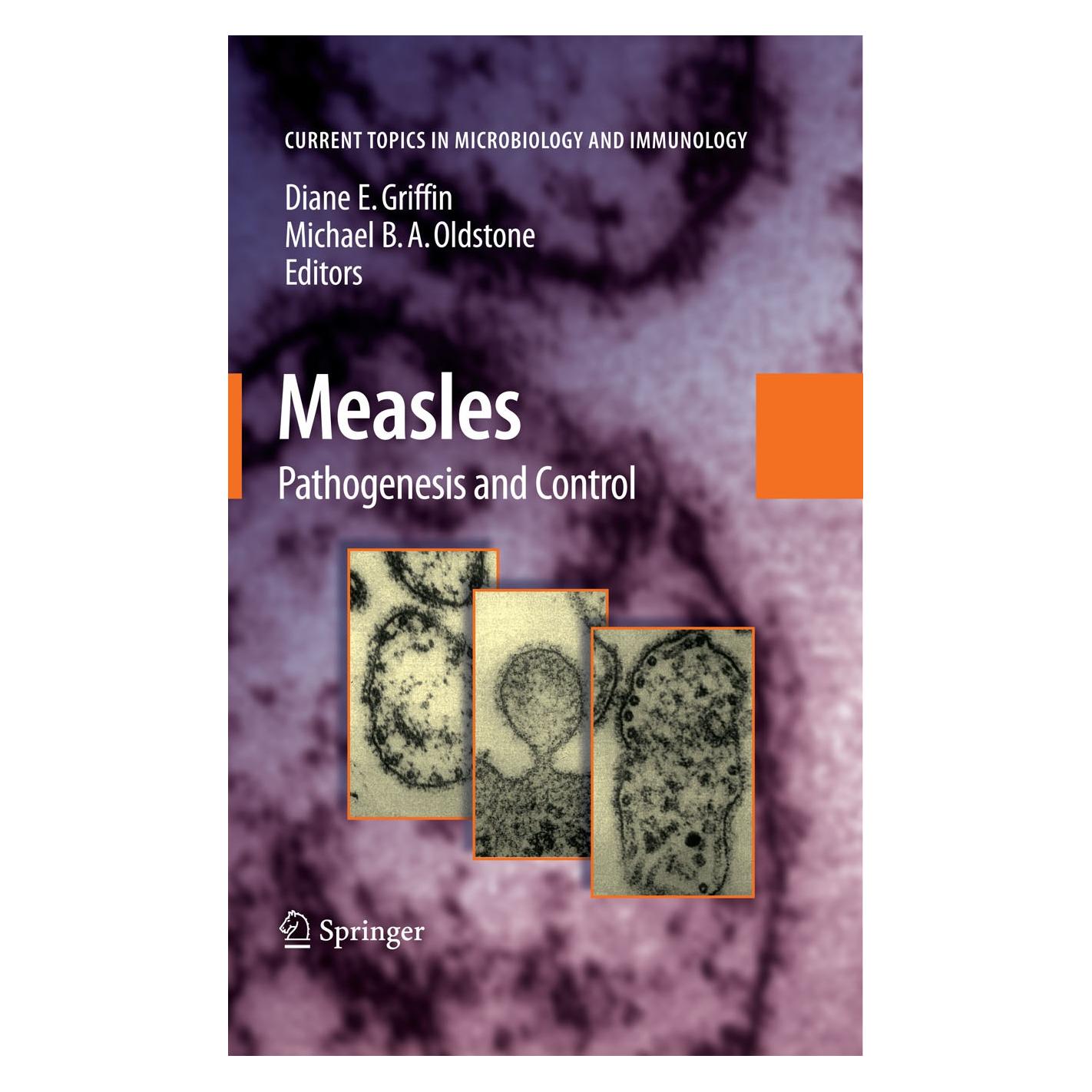 Springer Measles (Englisch, Hardcover, Diane E. Griffin, Michael B. A. Oldstone) (9783540706168)