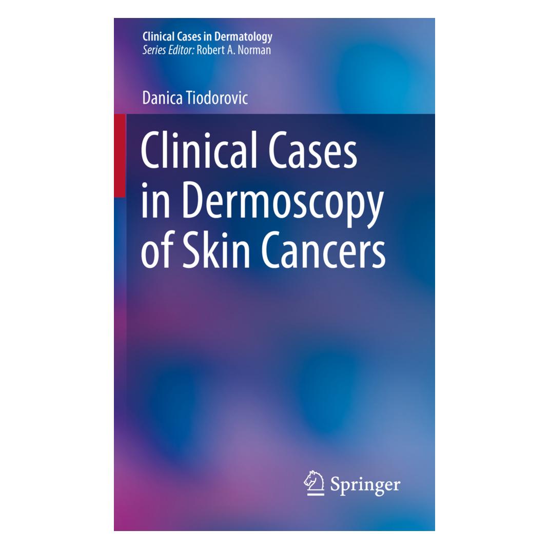 Springer Clinical Cases in Dermoscopy of Skin Cancers (Englisch, Softcover, Danica Tiodorovic) (56089743)