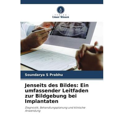 Jenseits des Bildes: Ein umfassender Leitfaden zur Bildgebung bei Implantaten, Taschenbuch von Soundarya S. Prabhu, Verlag Unser Wissen