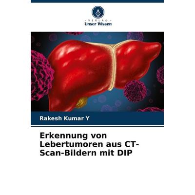 Erkennung von Lebertumoren aus CT-Scan-Bildern mit DIP, Taschenbuch von Rakesh Kumar Y., Verlag Unser Wissen, 978-620-6-94893-3