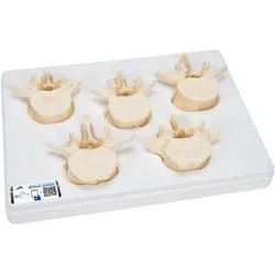 Wirbelmodell Set mit 5 BONElikeTM Lendenwirbeln - 3B Smart Anatomy