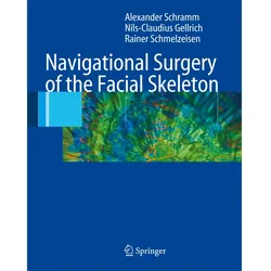 Navigational Surgery of the Facial Skeleton, Fachbücher von Rainer Schmelzeisen, Nils-Claudius Gellrich, Alexander Schramm