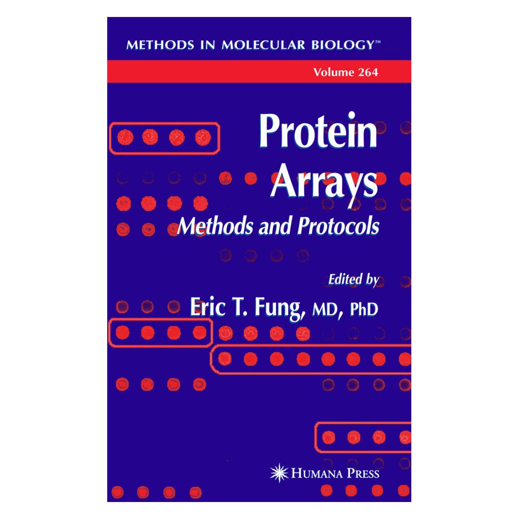 Springer Protein Arrays (Englisch, Softcover, Eric Fung) (55382733)