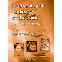 Interventional Radiology of the Spine, Fachbücher von J. Kevin McGraw
