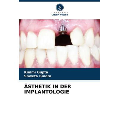 Ästhetik in der Implantologie, Taschenbuch von Kimmi Gupta,Shweta Bindra, Verlag Unser Wissen, 978-620-6-67046-9