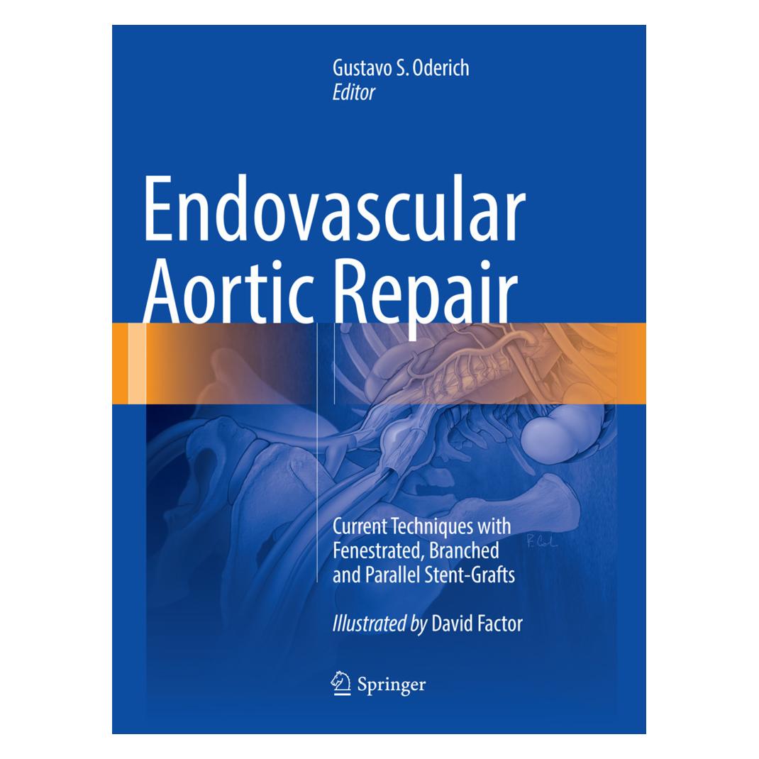 Springer Endovascular Aortic Repair (Englisch, Softcover, Gustavo S. Oderich) (55998580)