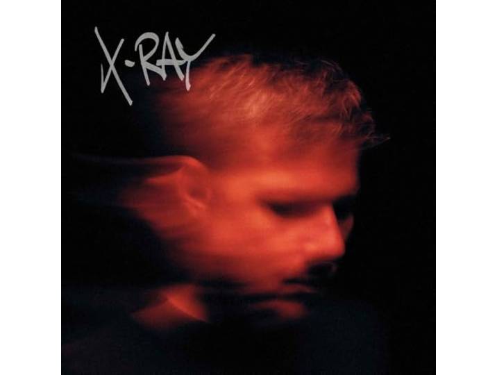 X-RAY
