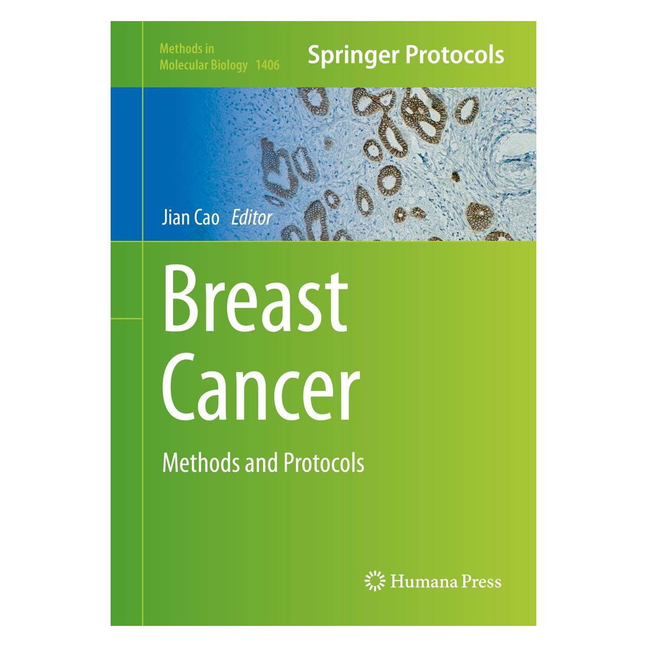 Springer Breast Cancer (Englisch, Hardcover, Jian Cao) (9781493934423)