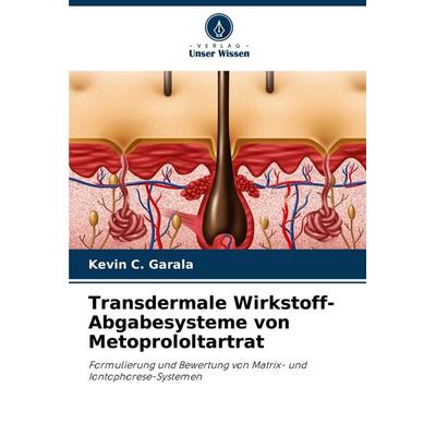 Transdermale Wirkstoff-Abgabesysteme von Metoprololtartrat, Taschenbuch von Kevin C. Garala, Verlag Unser Wissen, 978-620-8-30919-0