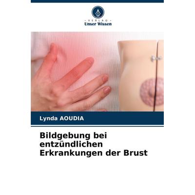 Bildgebung bei entzündlichen Erkrankungen der Brust, Taschenbuch von Lynda Aoudia, Verlag Unser Wissen, 978-620-7-68601-8